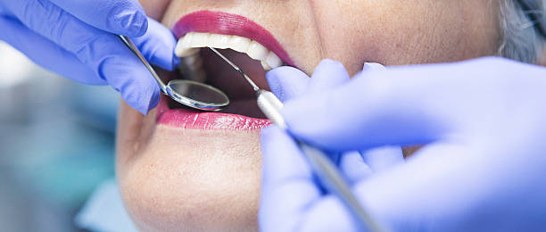 Best Emergency Dental Services for Seniors in Tiburon, CA